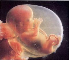 Fœtus