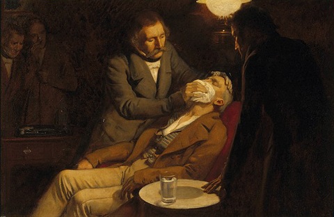Anesthésie à l'éther Anesthésie à l'éther